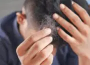 Hati-hati! Shampoo Dengan Senyawa Kimia Ini Bisa Bikin Kerontokan Rambut 8 Hati-hati! Shampoo Dengan Senyawa Kimia Ini Bisa Bikin Kerontokan Rambut